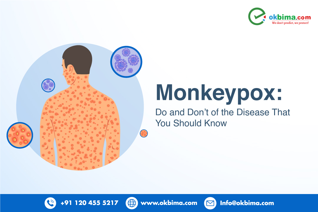 Monkeypox: Do and Don't of the Disease That You Should Know